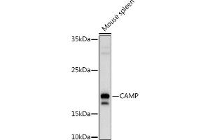 Western blot analysis of extracts of Mouse spleen, using (ABIN3022305, ABIN3022306, ABIN3022307, ABIN1512664 and ABIN6218724) at 1:1000 dilution.