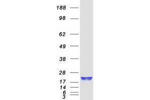 Validation with Western Blot