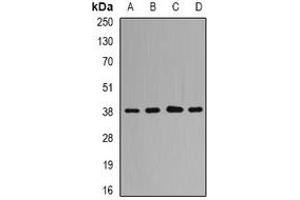 Western blot analysis of QKI expression in HL60 (A), Hela (B), mouse brain (C), rat liver (D) whole cell lysates. (QKI anticorps)