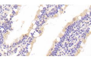 Detection of CASP10 in Human Small intestine Tissue using Polyclonal Antibody to Caspase 10 (CASP10)