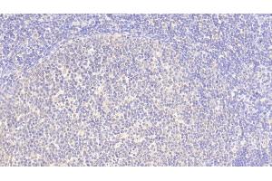Detection of SRGN in Human Lymph node Tissue using Polyclonal Antibody to Serglycin (SRGN) (SRGN anticorps  (AA 28-158))