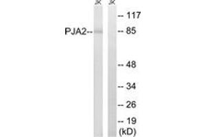 Western blot analysis of extracts from Jurkat cells, using PJA2 Antibody. (PJA2 anticorps  (AA 141-190))