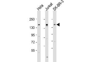 All lanes : Anti-FANCD2 Antibody (Center) at 1:2000 dilution Lane 1: Hela whole cell lysates Lane 2: Jurkat whole cell lysates Lane 3: SK-BR-3 whole cell lysates Lysates/proteins at 20 μg per lane.
