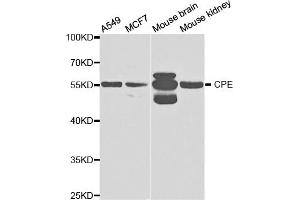 Western blot analysis of extracts of various cell lines, using CPE antibody (ABIN5973172) at 1/1000 dilution. (CPE anticorps)