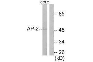 Western blot analysis of extracts from COLO205 cells, using AP-2 antibody.