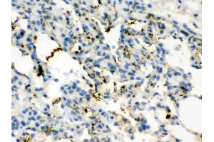 Calcitonin was detected in paraffin-embedded sections of rat lung tissues using rabbit anti- Calcitonin Antigen Affinity purified polyclonal antibody (Catalog # ) at 1 ? (CGRP anticorps  (C-Term))