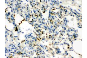 Calcitonin was detected in paraffin-embedded sections of rat lung tissues using rabbit anti- Calcitonin Antigen Affinity purified polyclonal antibody (Catalog # ) at 1 ?