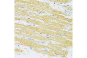 Immunohistochemistry of paraffin-embedded rat heart using TYROBP antibody (ABIN1876573) at dilution of 1:100 (40x lens). (TYROBP anticorps)