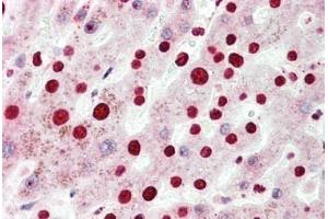 Human, Liver: Formalin-Fixed Paraffin-Embedded (FFPE)