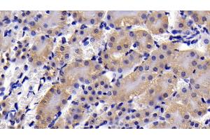 Detection of CASP3 in Mouse Kidney Tissue using Polyclonal Antibody to Caspase 3 (CASP3)