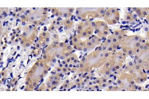 Detection of CASP3 in Mouse Kidney Tissue using Polyclonal Antibody to Caspase 3 (CASP3) (Caspase 3 anticorps  (AA 29-175))