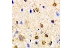 Immunohistochemical analysis of PSKH1 staining in human brain formalin fixed paraffin embedded tissue section.