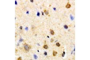 Immunohistochemical analysis of PSKH1 staining in human brain formalin fixed paraffin embedded tissue section. (PSKH1 anticorps)