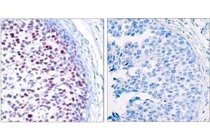 Image no. 3 for anti-Jun Proto-Oncogene (JUN) (pThr239) antibody (ABIN196653) (C-JUN anticorps  (pThr239))