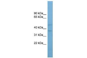 AADACL4 antibody used at 1 ug/ml to detect target protein.