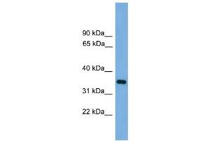 WB Suggested Anti-PRSS3 Antibody Titration: 0. (PRSS3 anticorps  (N-Term))