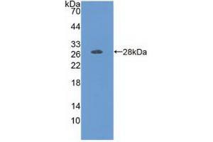 Western blot analysis of recombinant Human FOLR1. (FOLR1 anticorps  (AA 25-234))