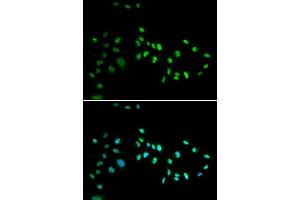Immunofluorescence analysis of A549 cell using DNMT3A antibody. (DNMT3A anticorps)
