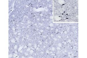 (ABIN184662) (scale bar: 50 μm, inset: 20 μm) immunostaining of NOS1 neurons in cryosection of a perfusion-fixed (4 % PFA) mouse caudate-putamen.
