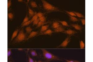 Immunofluorescence analysis of C6 cells using NRBF2 Polyclonal Antibody at dilution of 1:100.