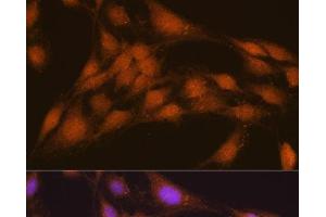 Immunofluorescence analysis of C6 cells using NRBF2 Polyclonal Antibody at dilution of 1:100. (NRBF2 anticorps)