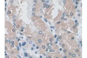 Detection of ERK1 in Human Stomach Tissue using Polyclonal Antibody to Extracellular Signal Regulated Kinase 1 (ERK1)