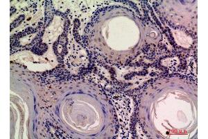 anti-MOB3A/B antibody