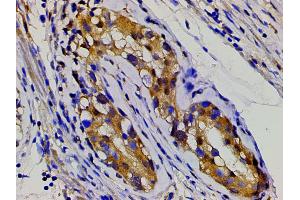ABIN6277691 at 1/200 staining human seminoma tissue sections by IHC-P. (Ephrin B2 anticorps  (C-Term))