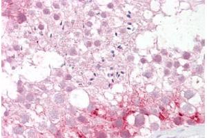 Anti-ABCD3 / PMP70 antibody IHC staining of human testis.