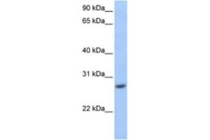 Western Blotting (WB) image for anti-Glutathione S-Transferase mu 3 (Brain) (GSTM3) antibody (ABIN2463566) (GSTM3 anticorps)