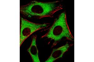 Fluorescent image of Hela cells stained with RPLP0P6 Antibody (N-term) (ABIN1881762 and ABIN2843386). (RPLP0P6 anticorps  (N-Term))