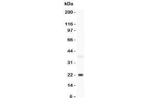 Western blot testing of Bid antbody and mouse brain lysate. (BID anticorps  (C-Term))
