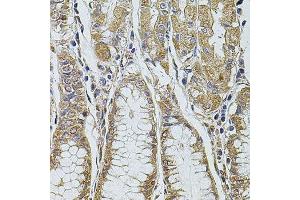 Immunohistochemistry of paraffin-embedded human stomach using PDCD6IP antibody. (ALIX anticorps  (AA 1-180))