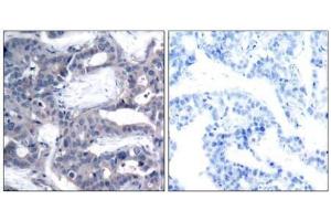Image no. 3 for anti-Mitogen-Activated Protein Kinase Kinase 2 (MAP2K2) (pThr394) antibody (ABIN196622) (MEK2 anticorps  (pThr394))