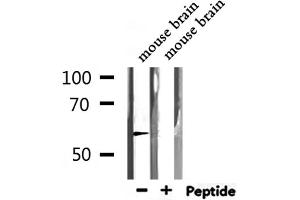 Western blot analysis of extracts from mouse brain, using TRIM21  Antibody. (TRIM21 anticorps  (C-Term))