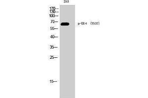 Western Blotting (WB) image for anti-Estrogen Receptor 1 (ESR1) (pTyr537) antibody (ABIN3182534) (Estrogen Receptor alpha anticorps  (pTyr537))