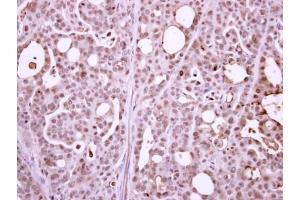 IHC-P Image Immunohistochemical analysis of paraffin-embedded NCIN87 xenograft, using RPB2, antibody at 1:500 dilution.