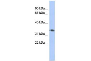 WB Suggested Anti-HOXD10 Antibody Titration:  0. (HOXD10 anticorps  (Middle Region))