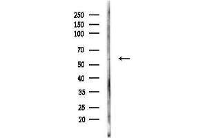 anti-Cytochrome B5 Reductase 4 (CYB5R4) (N-Term) antibody