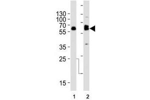 Western blot analysis of lysate from (1) SW480 and (2) U-87 MG cell line using TH antibody at 1:1000. (Tyrosine Hydroxylase anticorps  (AA 486-514))