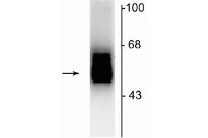 Western blot of 7 µg of rat cerebellar lysate showing specific immunolabeling of the ~55 kDa β2-subunit of the GABAA-R. (GABRB2 anticorps  (Cytosolic))