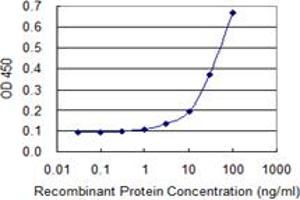 Detection limit for recombinant GST tagged GTF2IRD1 is 1 ng/ml as a capture antibody.