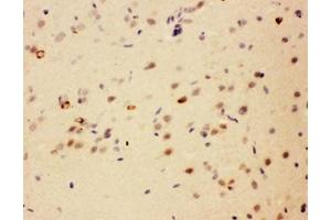IHC testing of FFPE rat brain with SIP antibody. (CACYBP anticorps  (Middle Region))