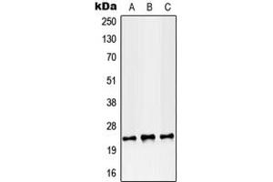 Western blot analysis of RAB38 expression in MCF7 (A), SP2/0 (B), PC12 (C) whole cell lysates. (RAB38 anticorps  (Center))