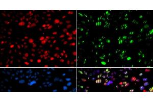 Immunofluorescence analysis of GFP-RNF168 transgenic U2OS cells using PNKP Polyclonal Antibody (PNKP anticorps)
