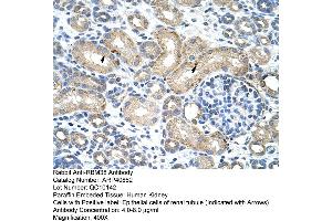 Rabbit Anti-RBM38 Antibody  Paraffin Embedded Tissue: Human Kidney Cellular Data: Epithelial cells of renal tubule Antibody Concentration: 4. (RBM38 anticorps  (N-Term))