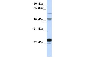 WB Suggested Anti-EVX1 Antibody Titration: 0. (EVX1 anticorps  (N-Term))