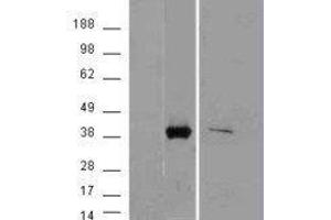 Western Blotting (WB) image for Aldo-Keto Reductase Family 1, Member B10 (Aldose Reductase) (AKR1B10) peptide (ABIN369716) (Aldo-Keto Reductase Family 1, Member B10 (Aldose Reductase) (AKR1B10) Peptide)