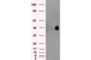 Image no. 1 for anti-Forkhead Box A1 (FOXA1) antibody (ABIN1498292)