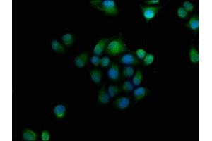 Immunofluorescence staining of Hela cells with ABIN7154719 at 1:166, counter-stained with DAPI. (GNAT3 anticorps  (AA 2-354))